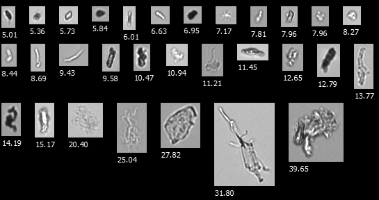 FlowCam collage of AAV aggregates