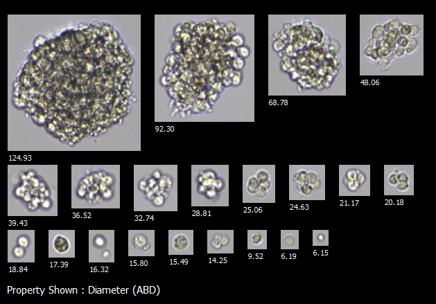 FlowCam collage of organoids