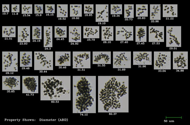 FlowCam collage microcystis