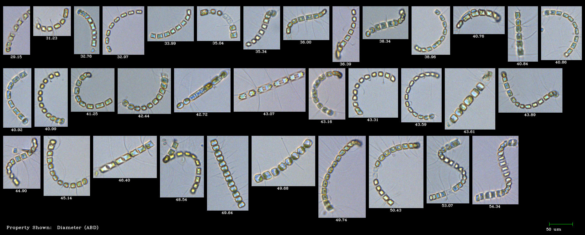 FlowCam collage phytoplankton - Chaetoceros