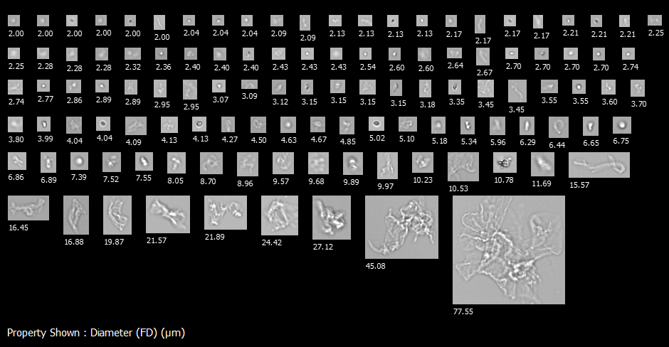 lentivirus aggregates