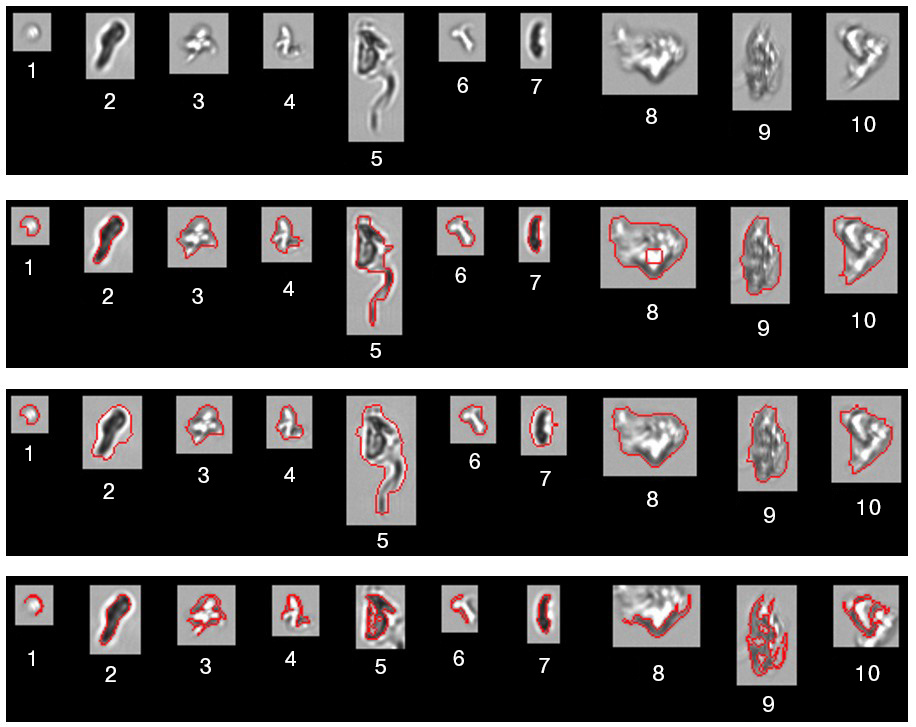 FlowCam Capture Settings for Biopharmaceutical Applications